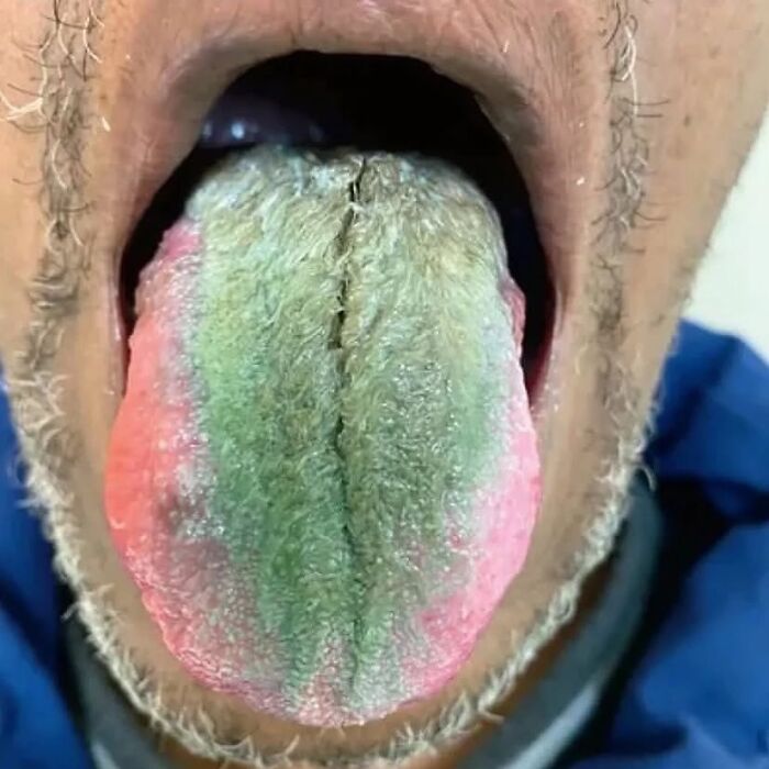 &ldquo;Green Hairy Tongue!&rdquo;: These 41 Medical Images That Should Be Viewed With Caution (New Pics)