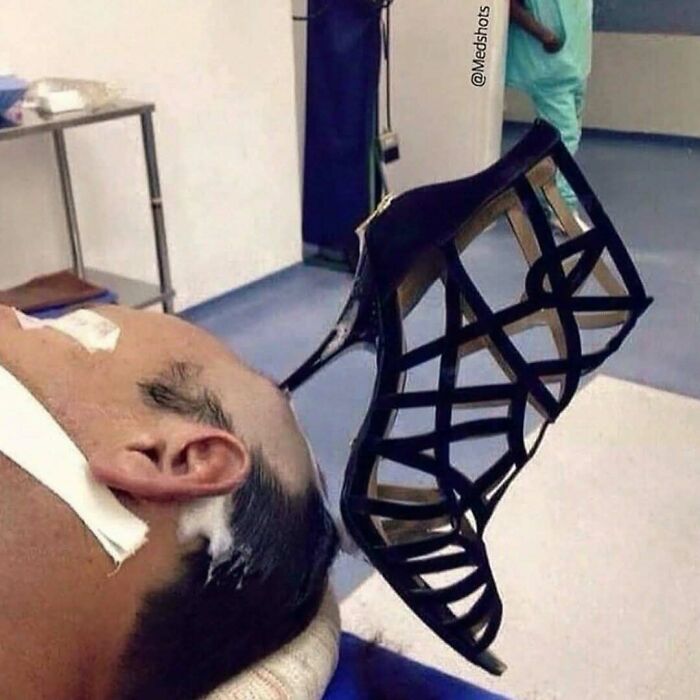 &ldquo;Green Hairy Tongue!&rdquo;: These 41 Medical Images That Should Be Viewed With Caution (New Pics)