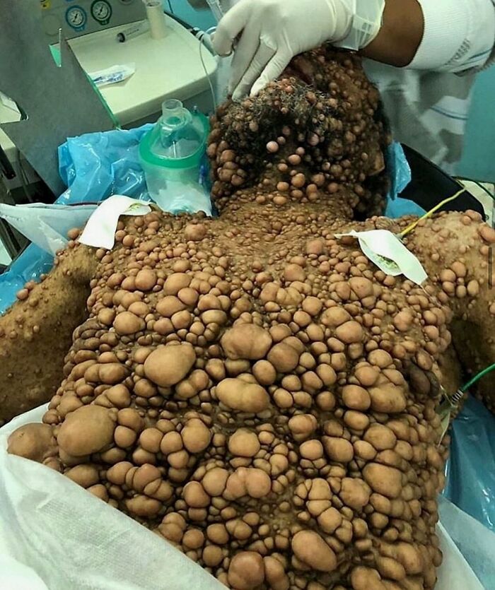 &ldquo;Green Hairy Tongue!&rdquo;: These 41 Medical Images That Should Be Viewed With Caution (New Pics)