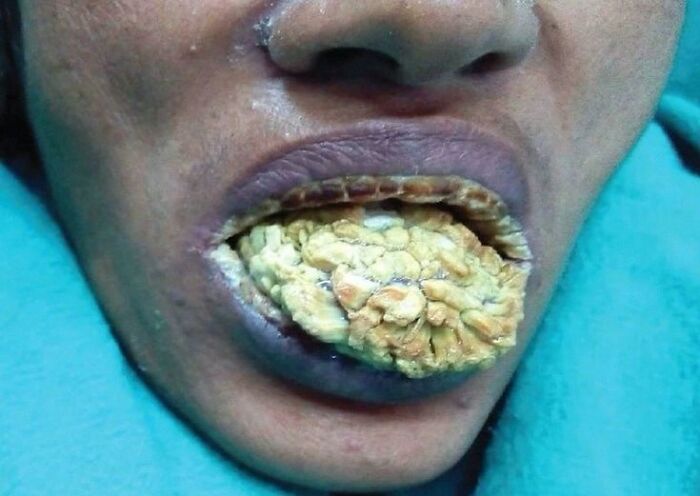 &ldquo;Green Hairy Tongue!&rdquo;: These 41 Medical Images That Should Be Viewed With Caution (New Pics)