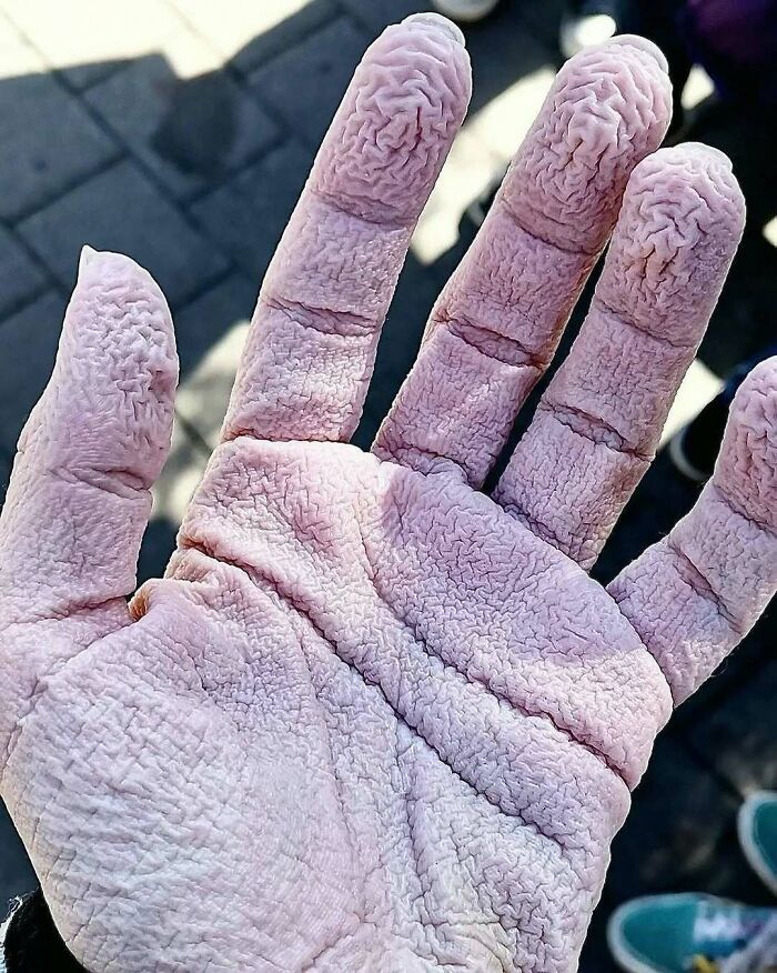 &ldquo;Green Hairy Tongue!&rdquo;: These 41 Medical Images That Should Be Viewed With Caution (New Pics)