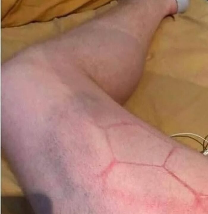 &ldquo;Green Hairy Tongue!&rdquo;: These 41 Medical Images That Should Be Viewed With Caution (New Pics)