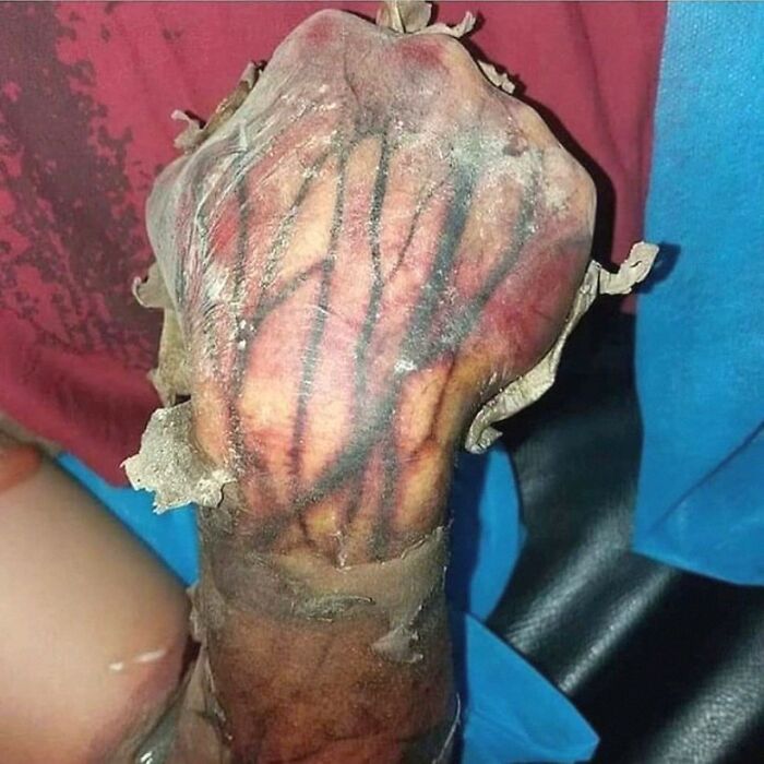 &ldquo;Green Hairy Tongue!&rdquo;: These 41 Medical Images That Should Be Viewed With Caution (New Pics)