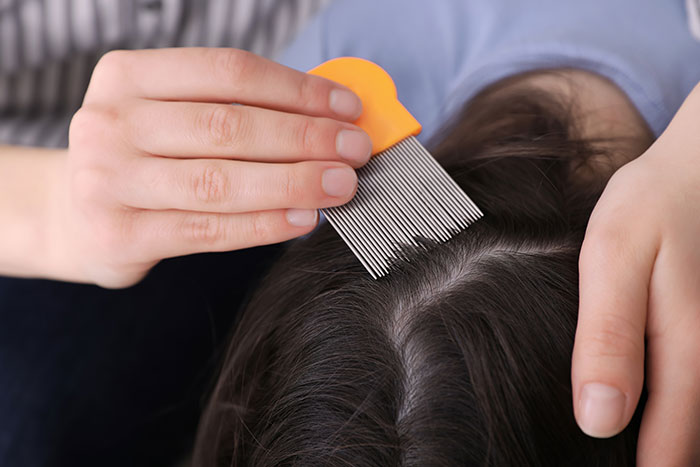 Wife Refuses To Treat Her Lice For Months, His Drastic &ldquo;No Whoopee&rdquo; Ultimatum Finally Works