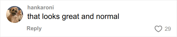 &ldquo;Someone PAID For This”: People Go Wild Mocking Woman&rsquo;s Before-And-After Cosmetic Procedure