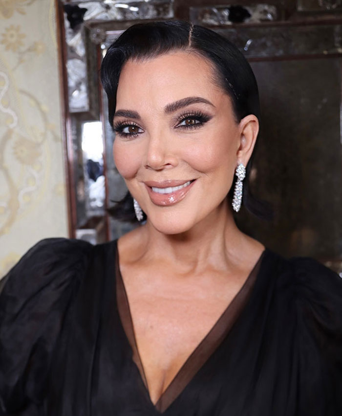 &ldquo;Someone PAID For This”: People Go Wild Mocking Woman&rsquo;s Before-And-After Cosmetic Procedure