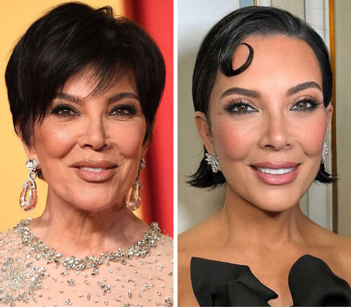 &ldquo;Someone PAID For This”: People Go Wild Mocking Woman&rsquo;s Before-And-After Cosmetic Procedure