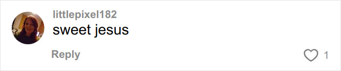 &ldquo;Someone PAID For This”: People Go Wild Mocking Woman&rsquo;s Before-And-After Cosmetic Procedure