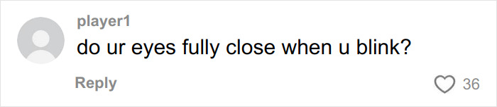 &ldquo;Someone PAID For This”: People Go Wild Mocking Woman&rsquo;s Before-And-After Cosmetic Procedure