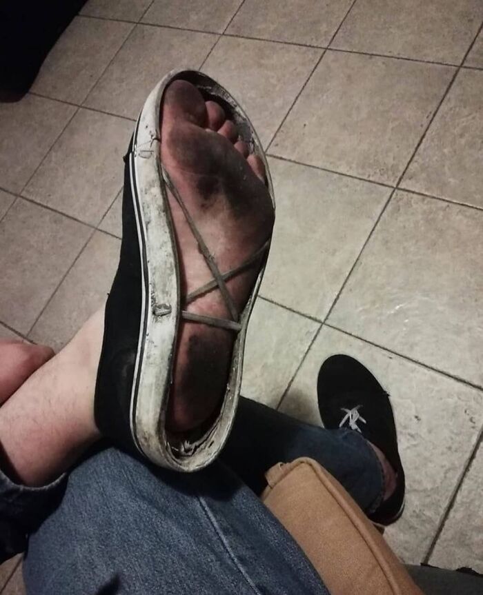 99 Photos That Are Quite Difficult To Look At Because Of How Weird And Cringey They Are