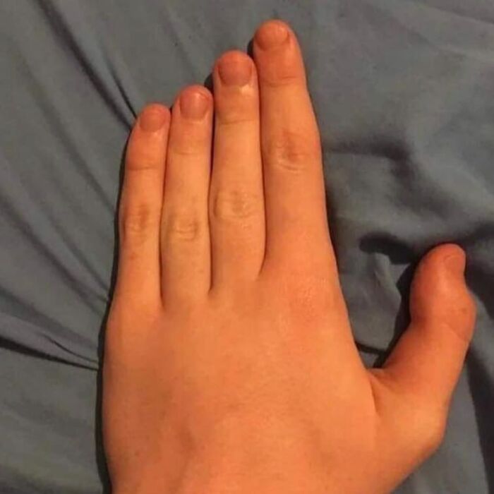 99 Photos That Are Quite Difficult To Look At Because Of How Weird And Cringey They Are