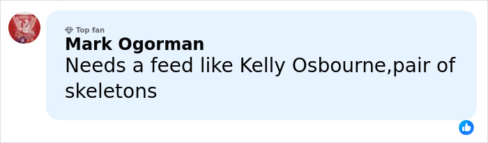 “This Has To Stop”: Anya Taylor‑Joy&rsquo;s Pre‑Oscars Dinner Appearance Leaves Fans Alarmed Over Spreading ‘Hollywood Trend’