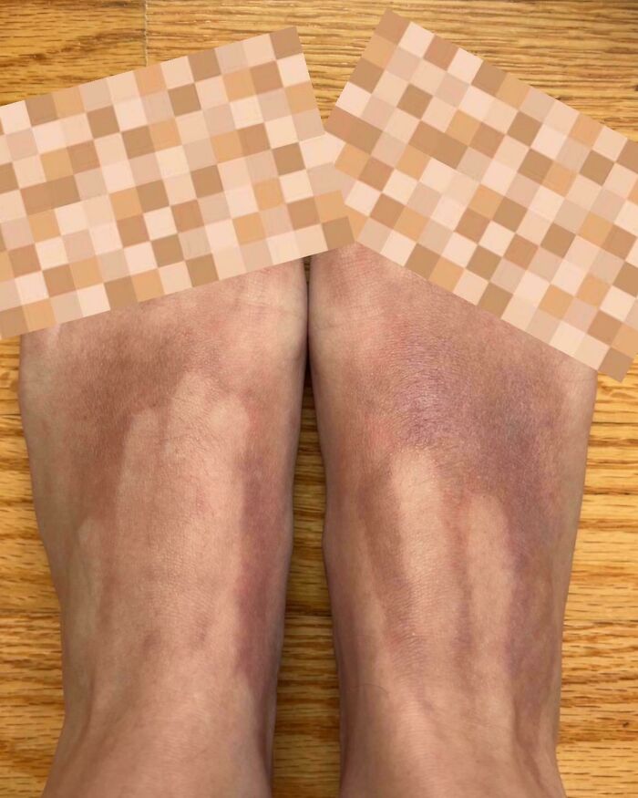 47 Times People Forgot To Think About ‘What Could Go Wrong’ And Ended Up With These Disasters (New Pics) 47 Times People Forgot To Think About ‘What Could Go Wrong’ And Ended Up With These Disasters (New Pics)