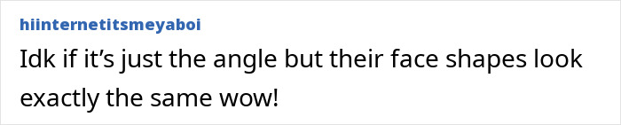 Body Language Expert Notices Something Between Kylie Jenner And Timothée Chalamet At Oscars 2026 Body Language Expert Notices Something Between Kylie Jenner And Timothée Chalamet At Oscars 2026