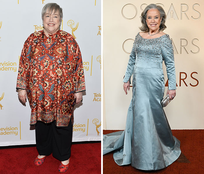 Oscars Red Carpet Stuns Fans As Plastic Surgery And Weight Loss Side Effects On Full Display Oscars Red Carpet Stuns Fans As Plastic Surgery And Weight Loss Side Effects On Full Display