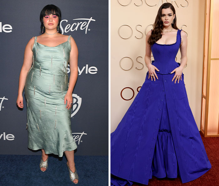 Oscars Red Carpet Stuns Fans As Plastic Surgery And Weight Loss Side Effects On Full Display Oscars Red Carpet Stuns Fans As Plastic Surgery And Weight Loss Side Effects On Full Display