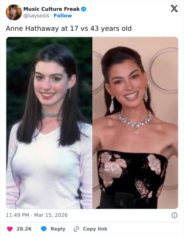 Anne Hathaway&rsquo;s Oscars Appearance Sparks Wild Reactions As Fans Notice Something Off