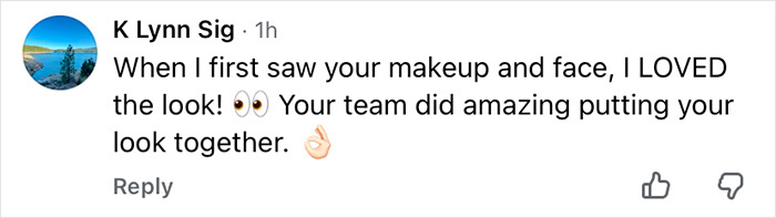 Anne Hathaway Reveals ‘Trick’ Behind Taut Face After Fans Scrutinized Her Oscars Appearance