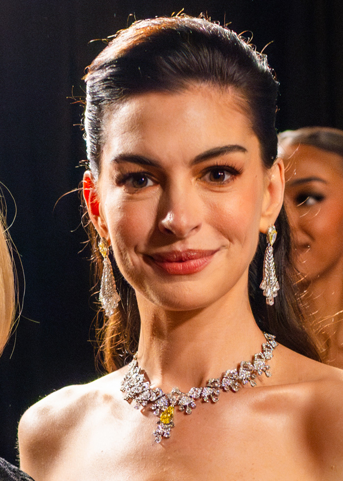 Anne Hathaway Reveals ‘Trick’ Behind Taut Face After Fans Scrutinized Her Oscars Appearance
