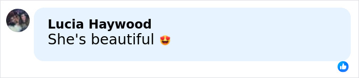 Anne Hathaway Reveals ‘Trick’ Behind Taut Face After Fans Scrutinized Her Oscars Appearance