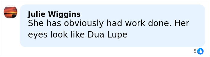 Anne Hathaway Reveals ‘Trick’ Behind Taut Face After Fans Scrutinized Her Oscars Appearance