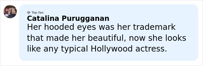 Anne Hathaway Reveals ‘Trick’ Behind Taut Face After Fans Scrutinized Her Oscars Appearance