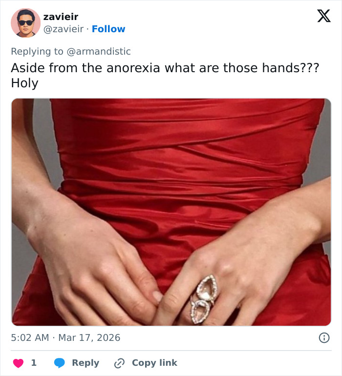 “Are We Supposed To Ignore This?”: People Notice Disturbing Detail In Photos Of Maude Apatow At Oscars Party