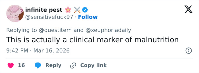 “Are We Supposed To Ignore This?”: People Notice Disturbing Detail In Photos Of Maude Apatow At Oscars Party