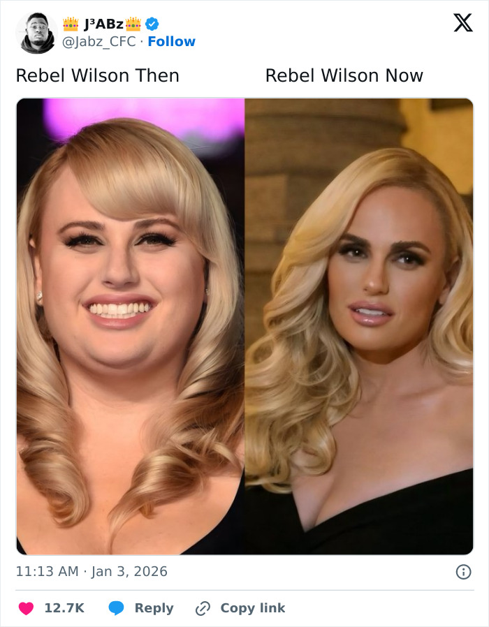 “Are We Supposed To Ignore This?”: People Notice Disturbing Detail In Photos Of Maude Apatow At Oscars Party