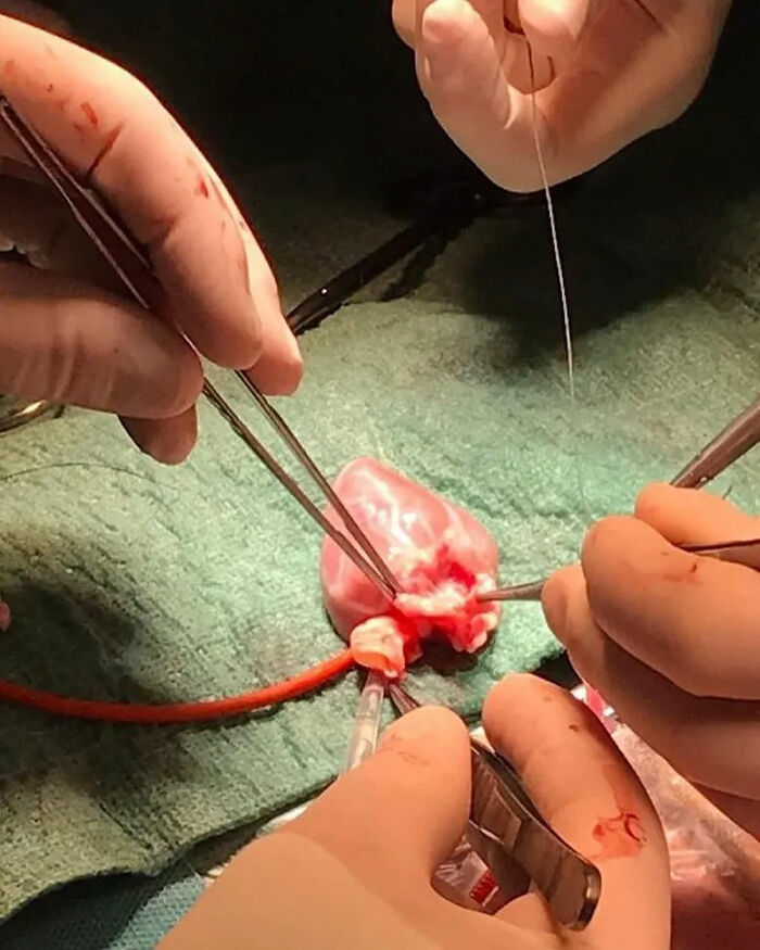 69 Unusual Medical Photos That Land Somewhere In Between Science And Nightmare