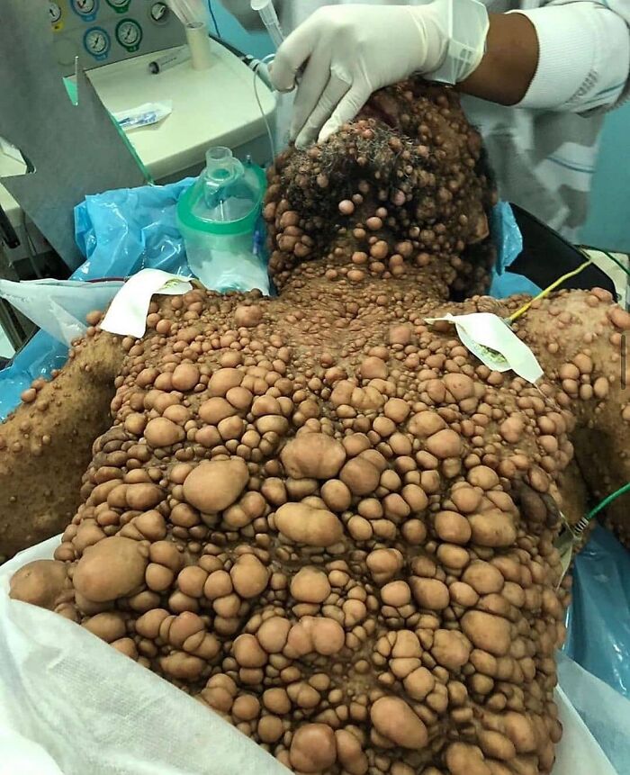 69 Unusual Medical Photos That Land Somewhere In Between Science And Nightmare