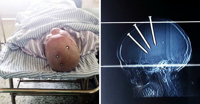 69 Unusual Medical Photos That Land Somewhere In Between Science And Nightmare