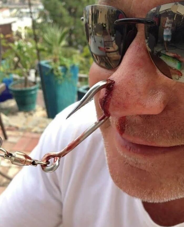 69 Unusual Medical Photos That Land Somewhere In Between Science And Nightmare