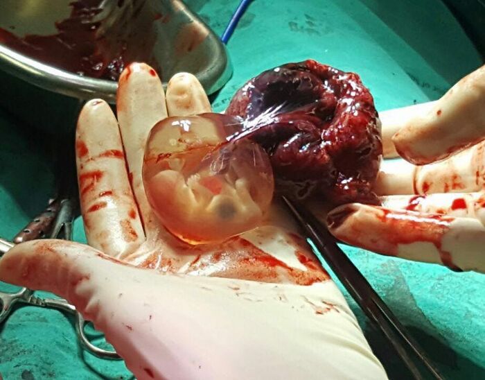 69 Unusual Medical Photos That Land Somewhere In Between Science And Nightmare