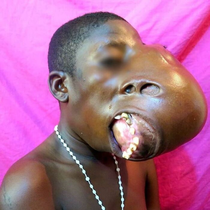 69 Unusual Medical Photos That Land Somewhere In Between Science And Nightmare