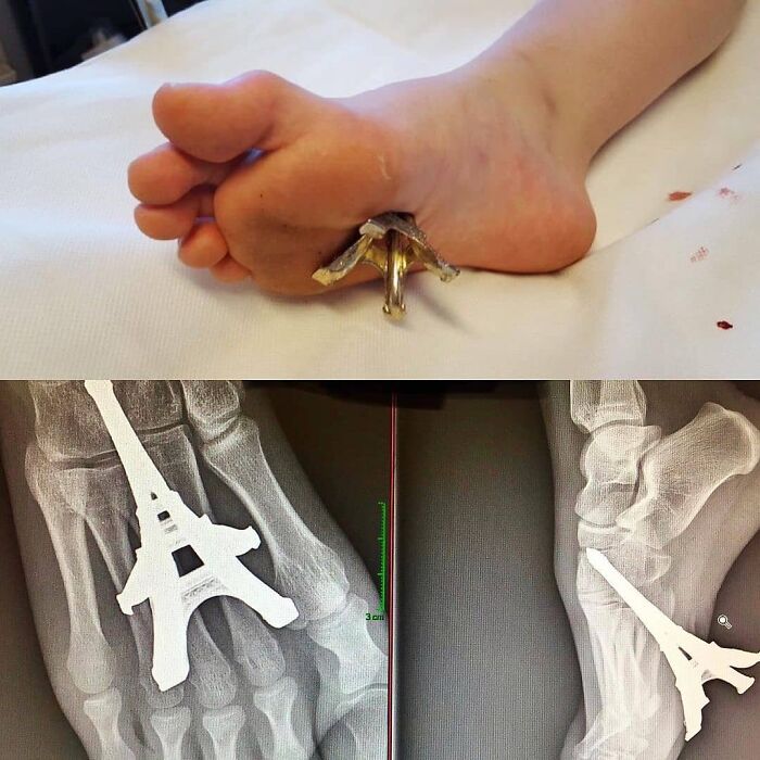 69 Unusual Medical Photos That Land Somewhere In Between Science And Nightmare