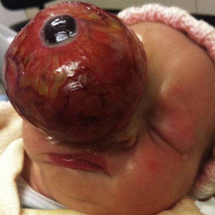 69 Unusual Medical Photos That Land Somewhere In Between Science And Nightmare