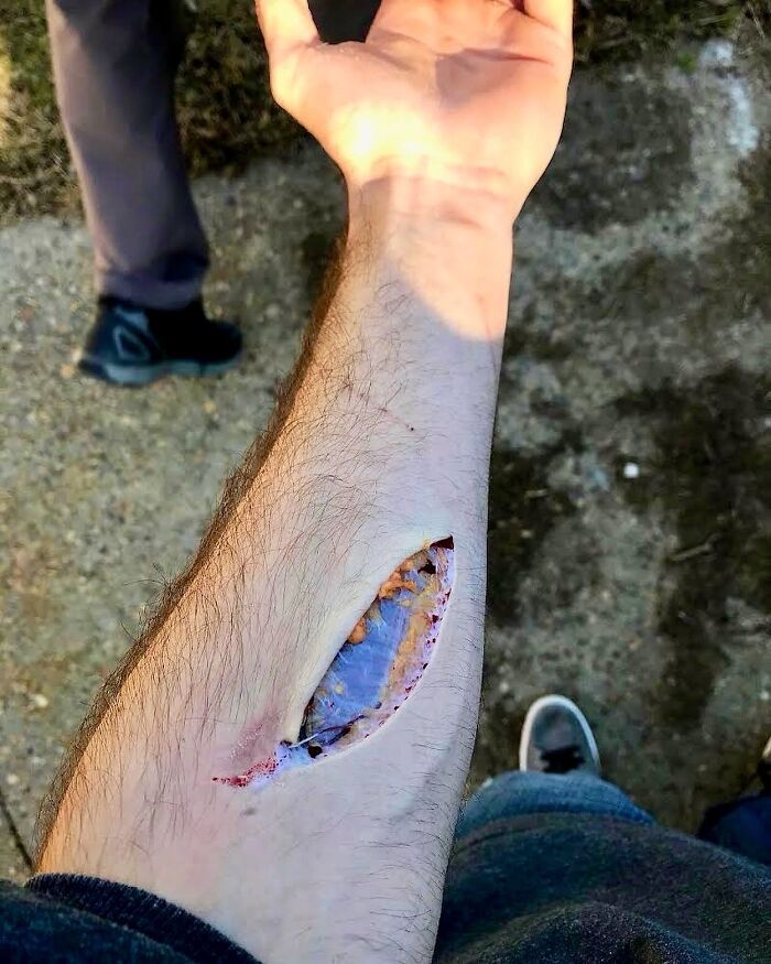 69 Unusual Medical Photos That Land Somewhere In Between Science And Nightmare