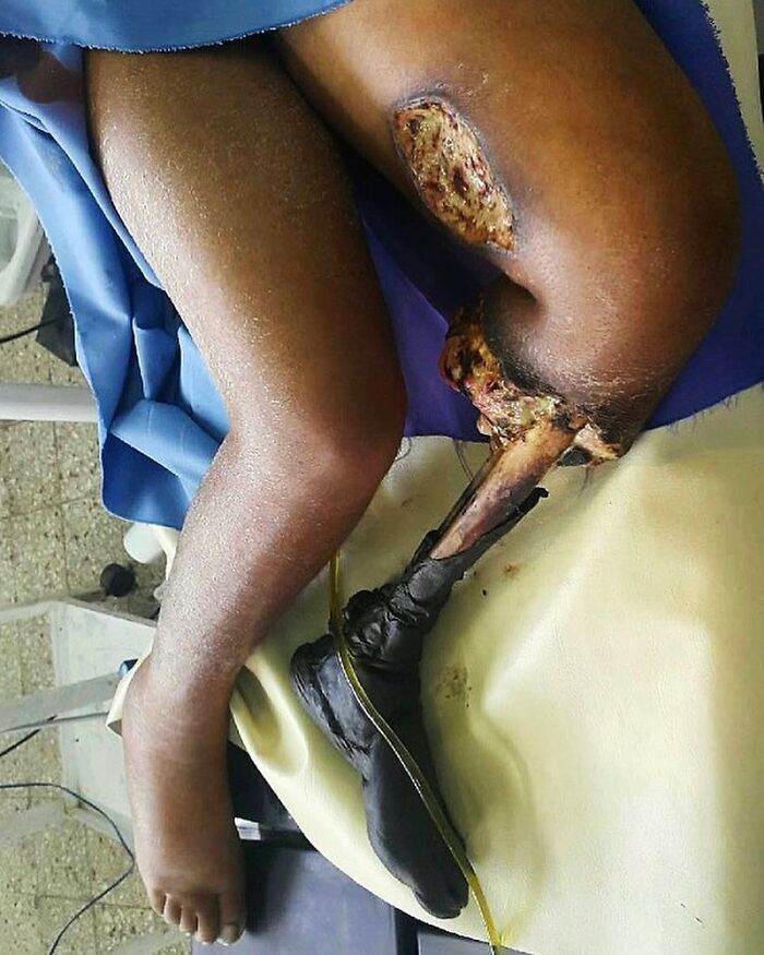 69 Unusual Medical Photos That Land Somewhere In Between Science And Nightmare