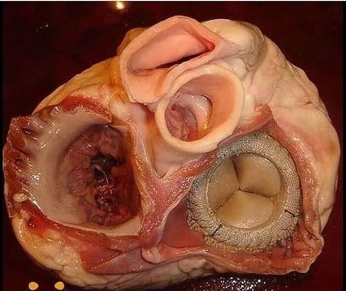 69 Unusual Medical Photos That Land Somewhere In Between Science And Nightmare