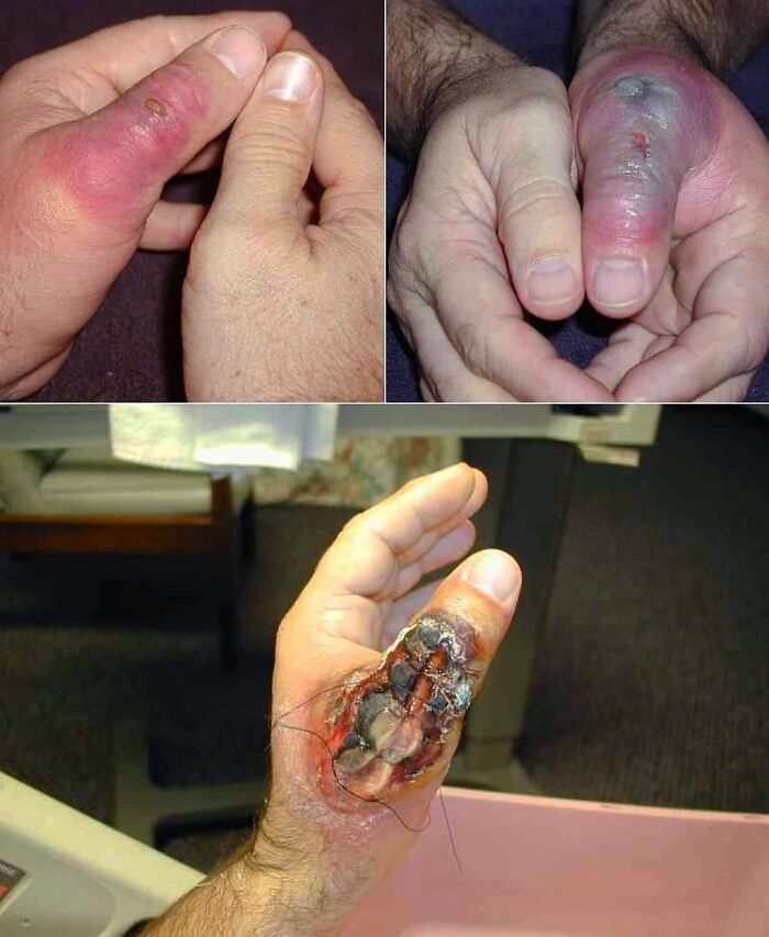 69 Unusual Medical Photos That Land Somewhere In Between Science And Nightmare