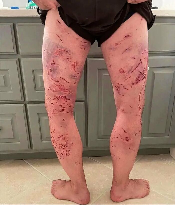 69 Unusual Medical Photos That Land Somewhere In Between Science And Nightmare