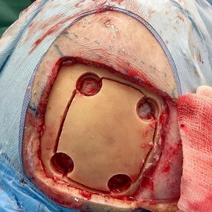 69 Unusual Medical Photos That Land Somewhere In Between Science And Nightmare