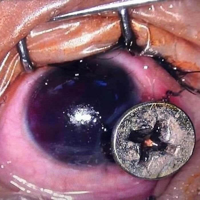 69 Unusual Medical Photos That Land Somewhere In Between Science And Nightmare