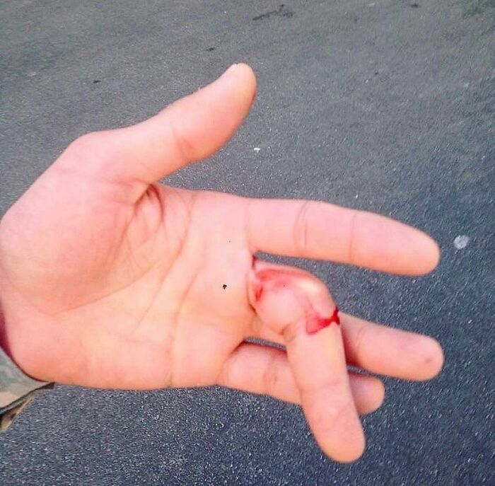 69 Unusual Medical Photos That Land Somewhere In Between Science And Nightmare