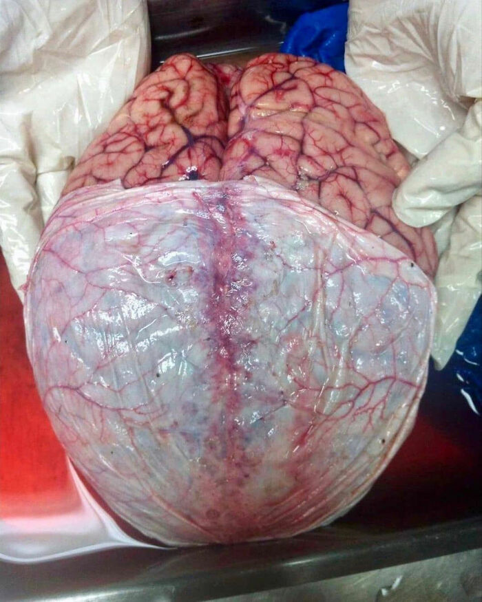 69 Unusual Medical Photos That Land Somewhere In Between Science And Nightmare