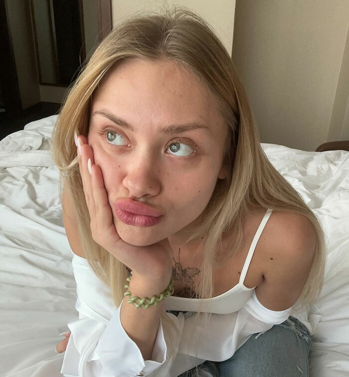 Model Found With Horrific Injuries On Dubai Roadside Poses For Pics As She Reveals Her Comeback