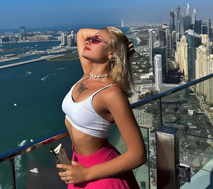 Model Found With Horrific Injuries On Dubai Roadside Poses For Pics As She Reveals Her Comeback