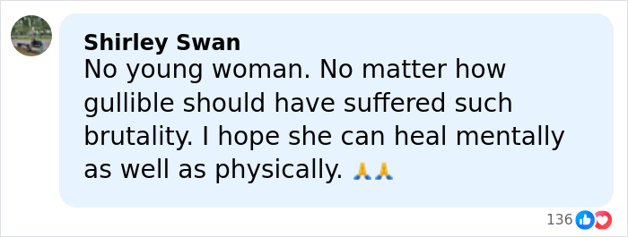 Model Found With Horrific Injuries On Dubai Roadside Poses For Pics As She Reveals Her Comeback