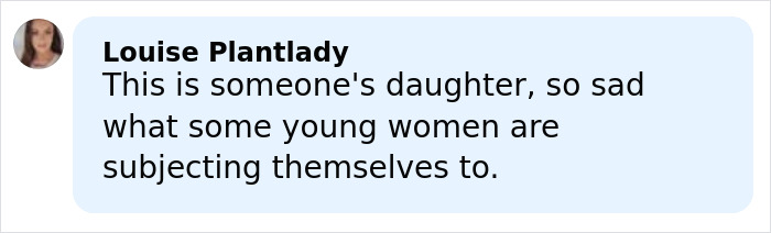 Model Found With Horrific Injuries On Dubai Roadside Poses For Pics As She Reveals Her Comeback